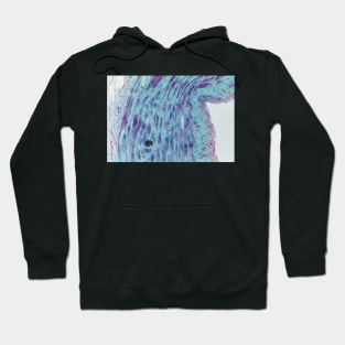 Saphenous vein, light micrograph (C023/7530) Hoodie